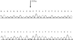 雪峰乌骨鸡胸肌黑色素沉积pmel17基因及遗传标记方法